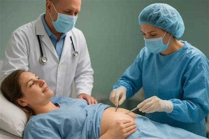 Are elective C-sections covered by insurance?