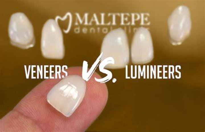 Are Lumineers cheaper than veneers?