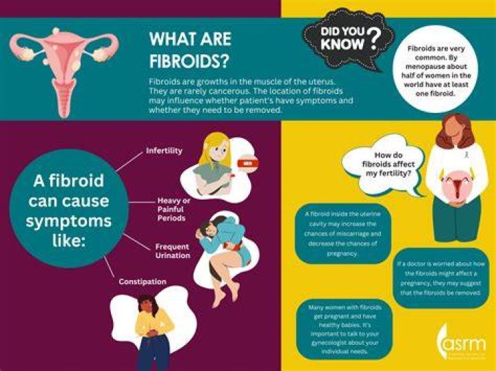 Can fibroids be considered a disability?