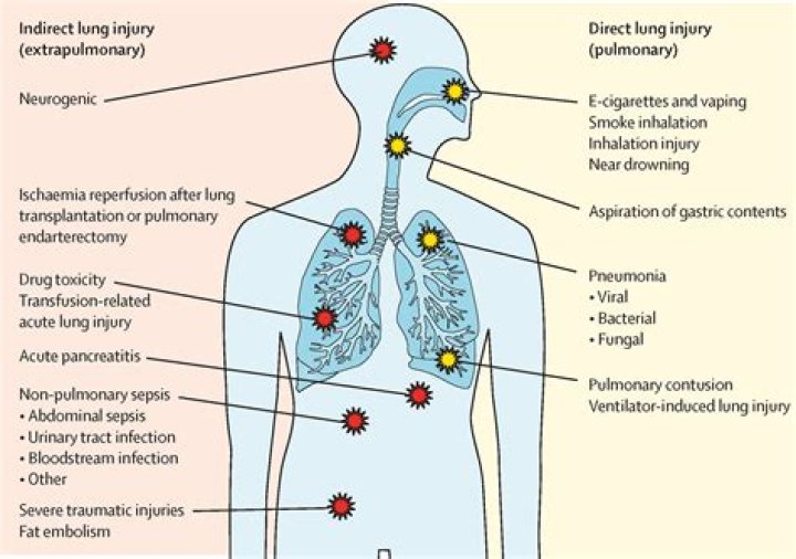 Can stress cause respiratory problems?