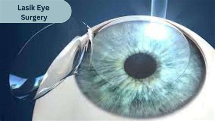 Can you go home after laser eye surgery?