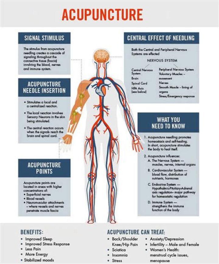 Does an acupuncture hurt?