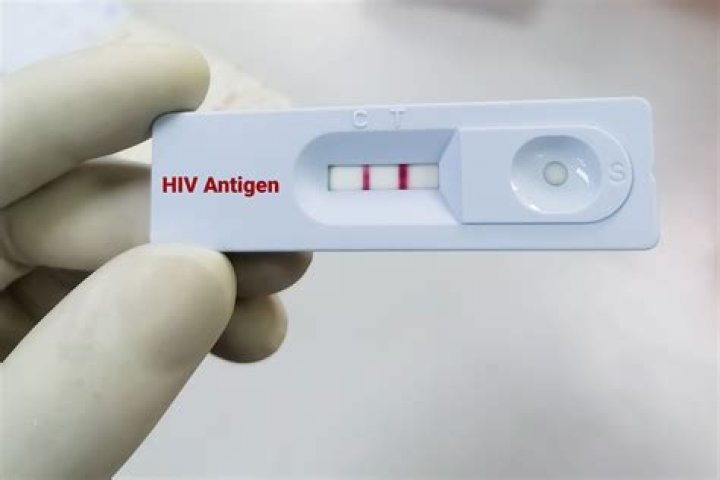 How do you deal with an HIV positive employee?