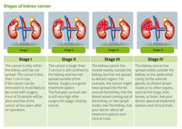 How long can you live with Stage 4 renal cancer?