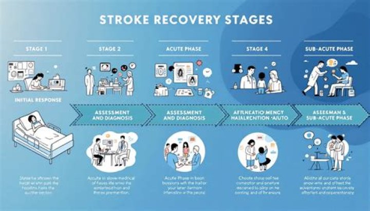 How long is inpatient rehab for stroke?