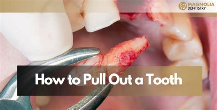 How much does a vet charge to pull a tooth?