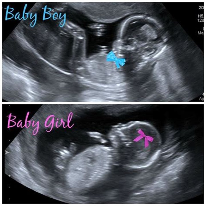 Is 16 weeks too early to find out gender?