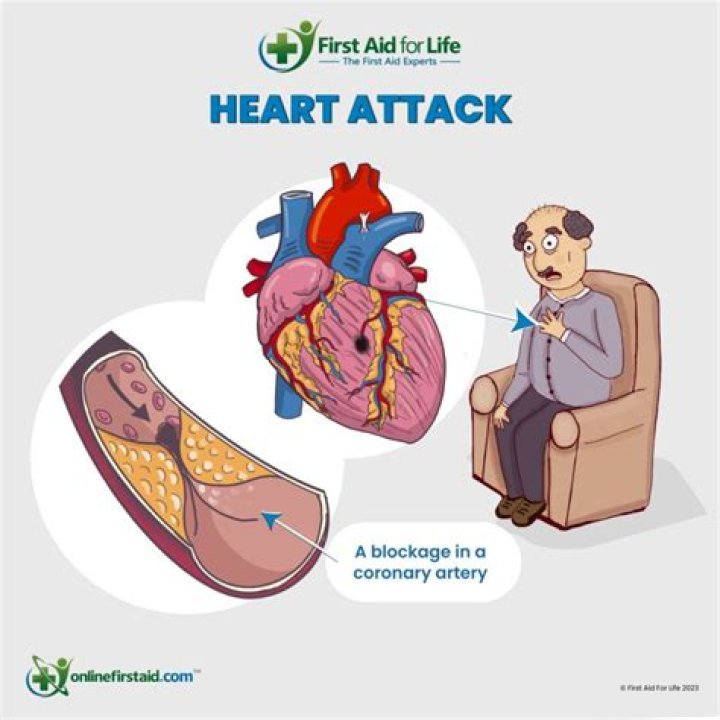Is a heart attack considered a pre-existing condition?