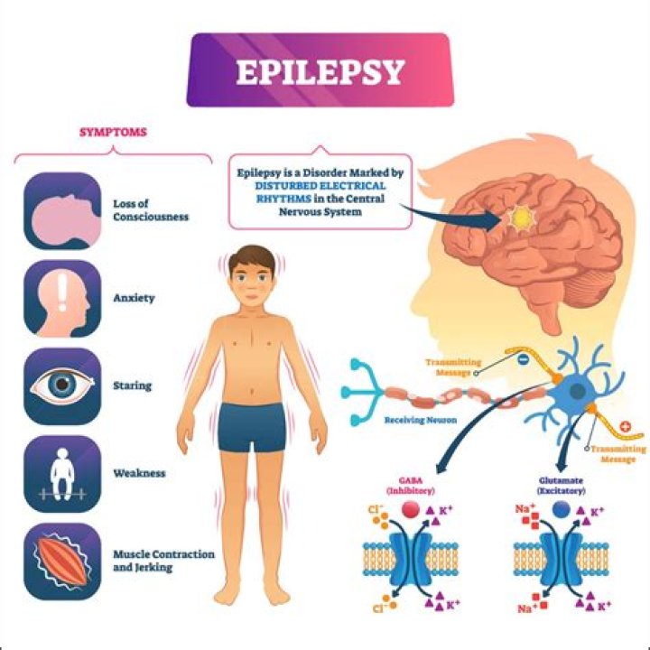 Is epilepsy covered in critical illness?