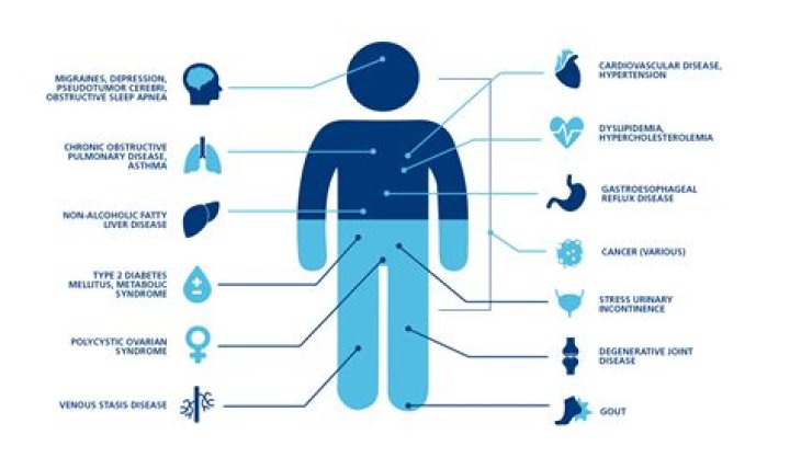What are the long term health effects of obesity?