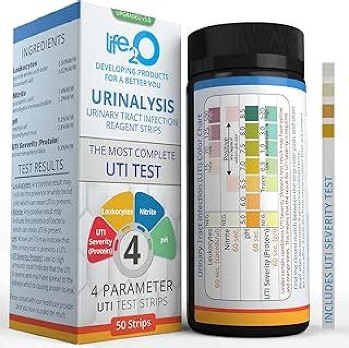 What does a standard urine test check for?