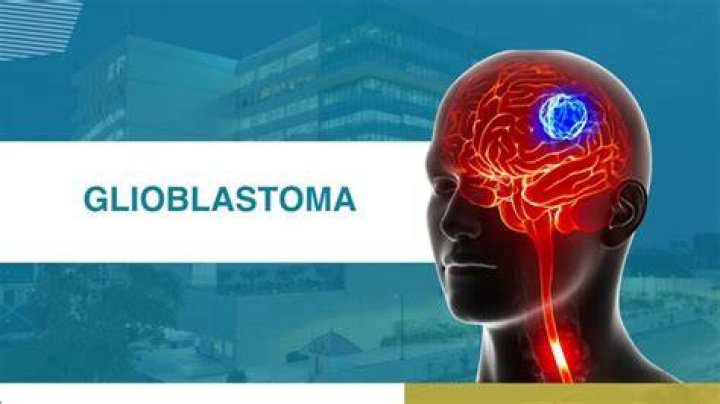 What is the best hospital for glioblastoma?