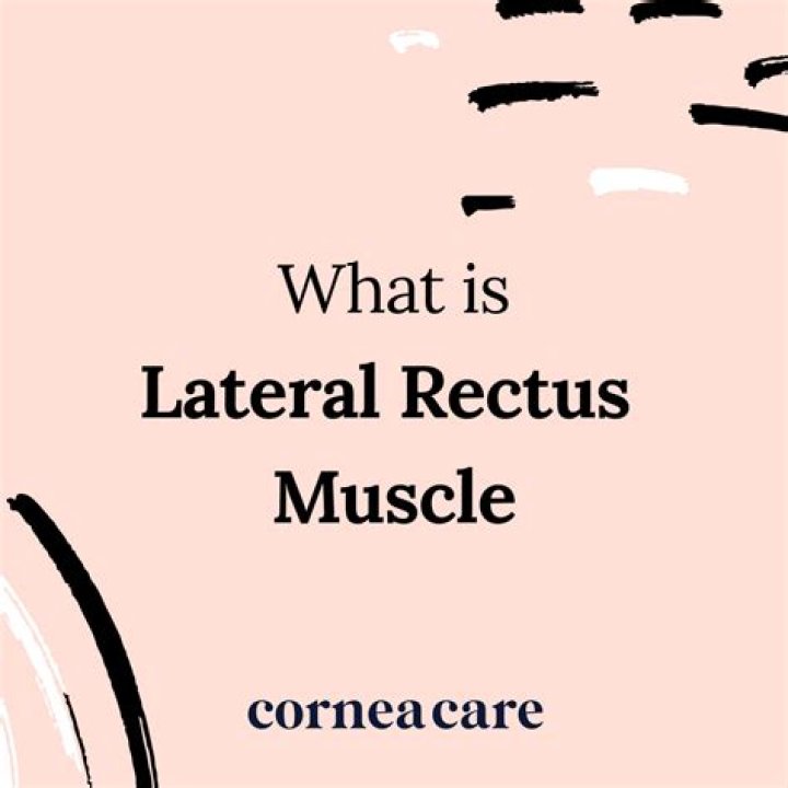 What type of muscle is the lateral rectus muscle?