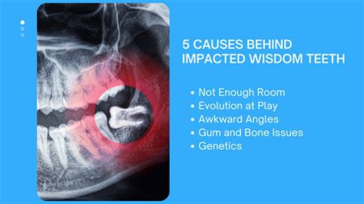 Who is impacted by SOX?