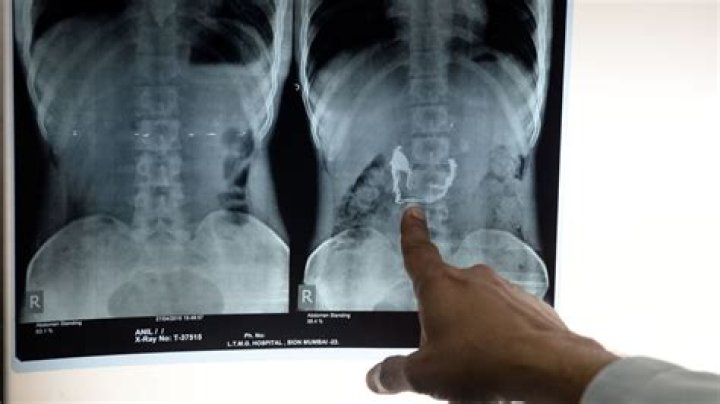 Who owns a patients x-rays?