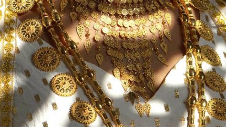 Why is gold unique?
