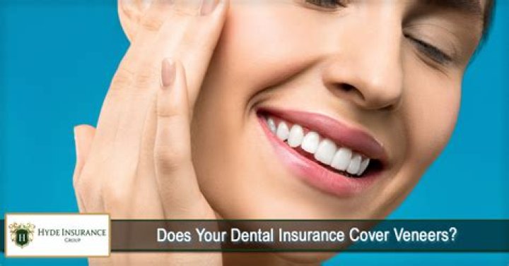 Will health insurance cover veneers?